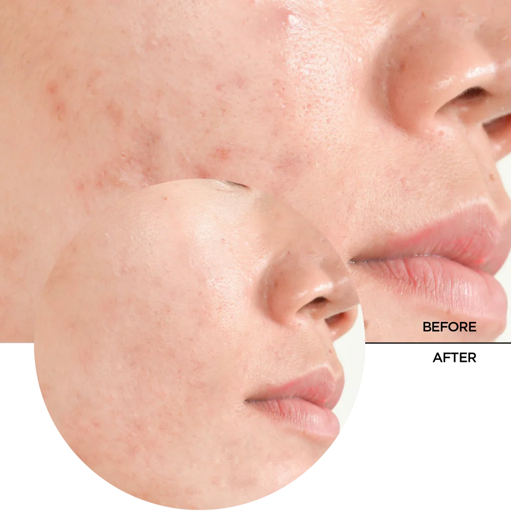 Revox Salicylic Acid 2% 30ml